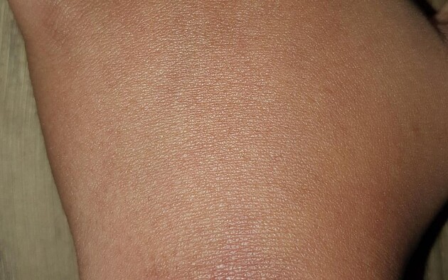 De ganglion van mevr. Bakker